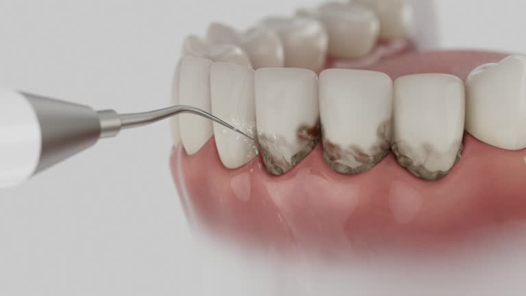 Trusted Invisalign Clear Aligners service in Warren, MI - Dentist Open Now